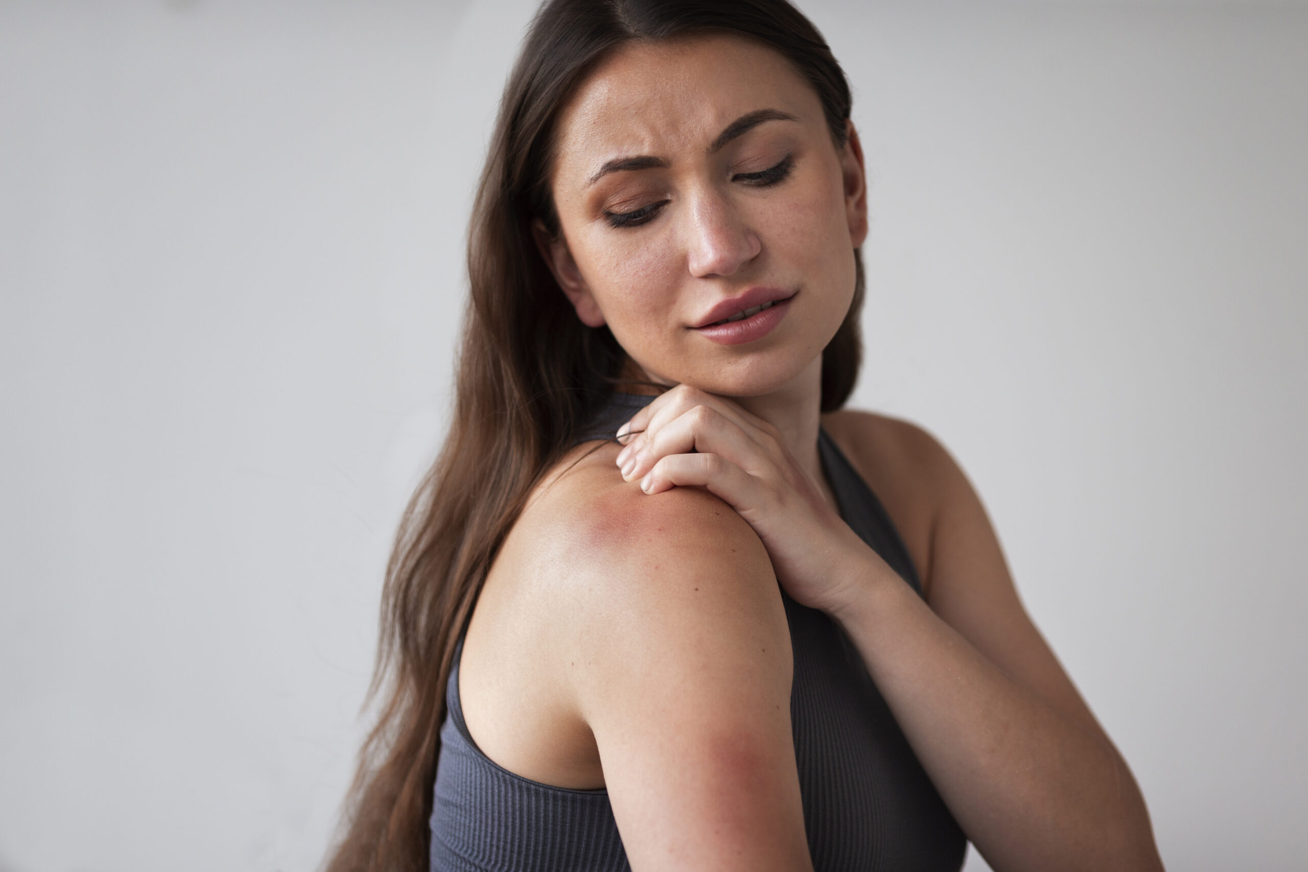 Anxiety Rash: The Mind-Body Connection and Can CBD Help?