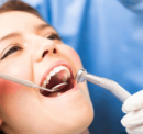 Everything You Need to Know About Root Canal Treatment